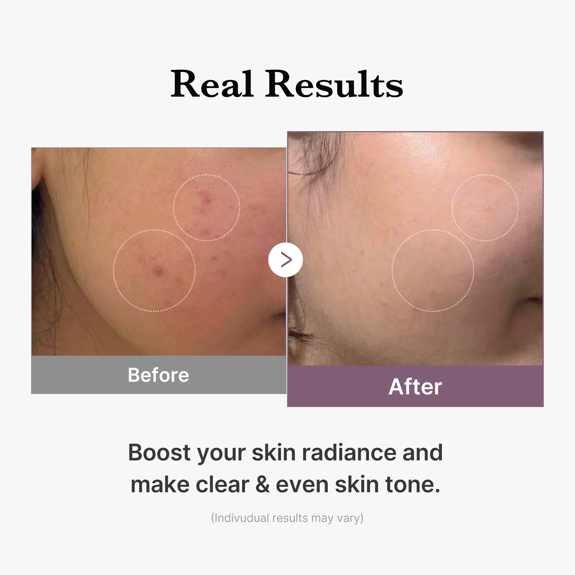 AGE-R Glutathione Glow Milk Toner - Image 5