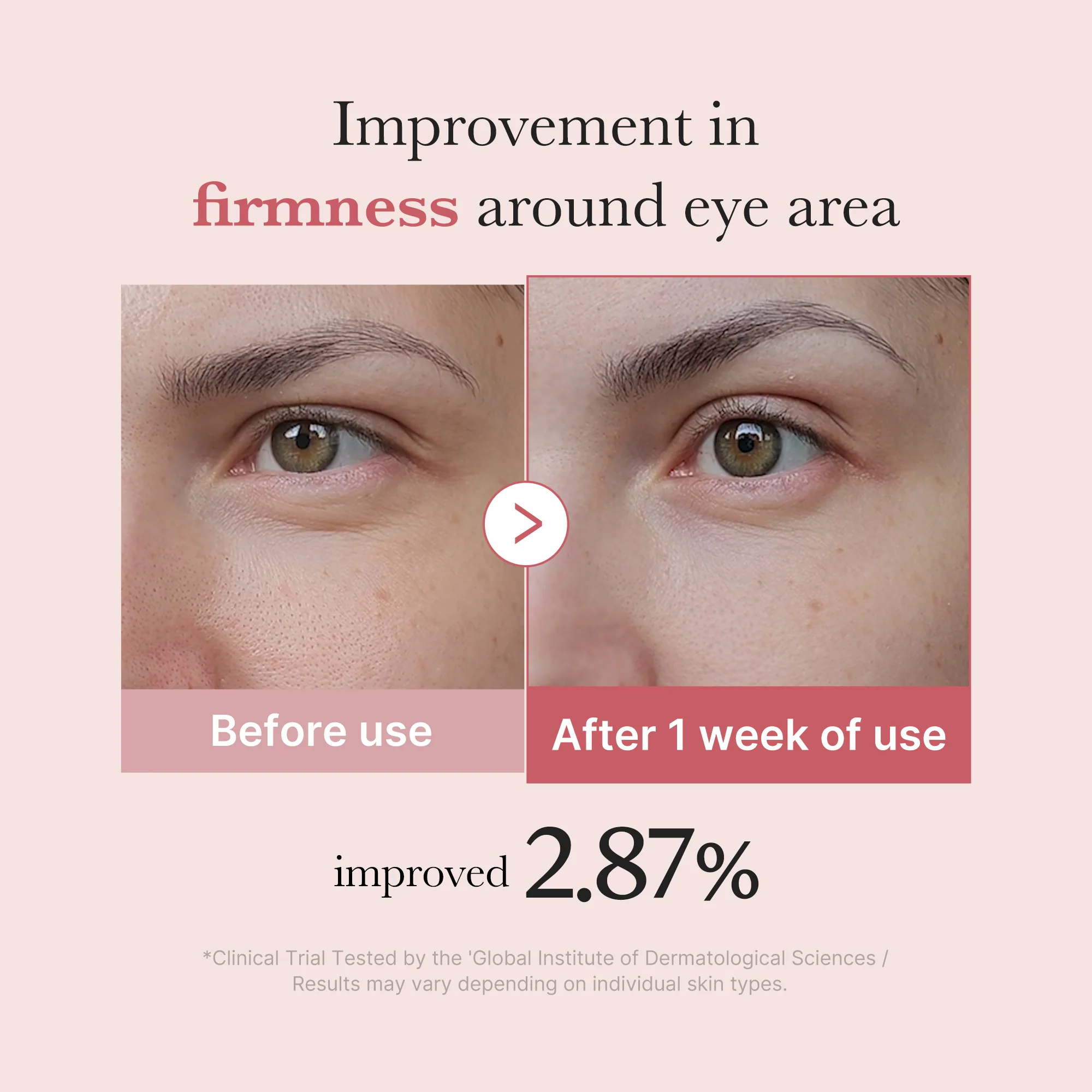 PDRN Pink Peptide Eye Cream - Image 4