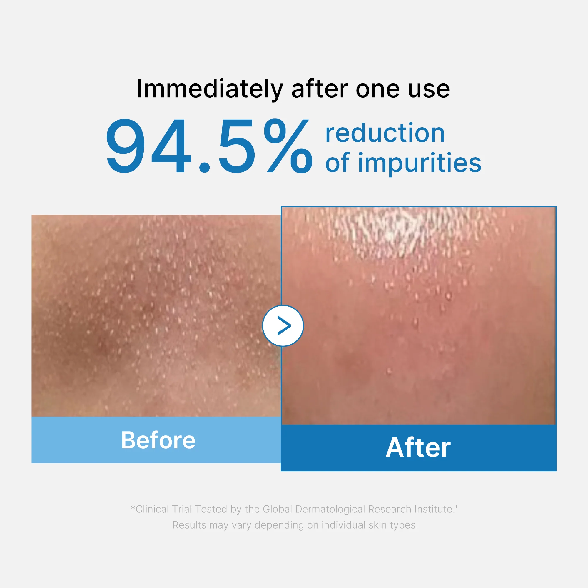 [GIFT] Zero Pore Blackhead Deep Cleansing Oil - Image 2